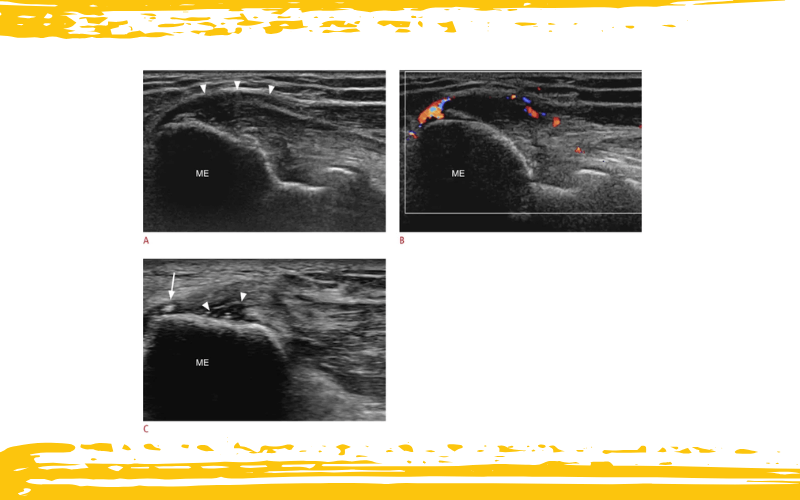 2. Diagnostico diferencial parte 1 ecografia tempo formacion.png